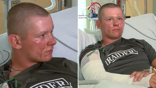 [Bintang] Ternyata Ini Alasan Mengapa Tanaman Hogweed Berbahaya Bagi Manusia