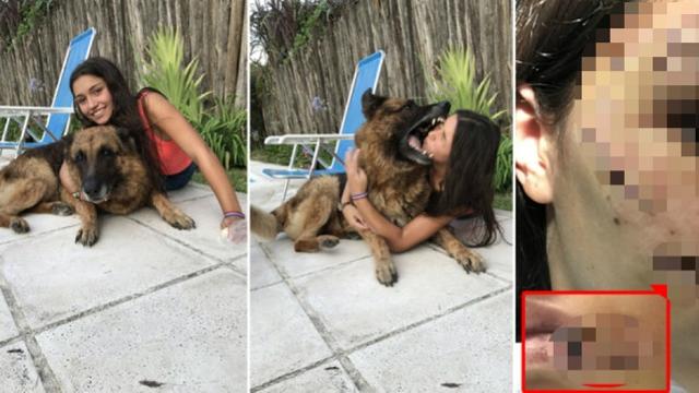 gadis digigit anjing peliharaan