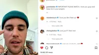 Wajah Lumpuh Sebelah, Justin Bieber Tak Bisa Kedipkan Mata dan Tersenyum Salah Satu Sisi