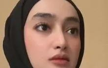 Potret Lawas Santyka Fauziah Sebelum Resmi Jadi Pacar Sule