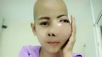 Seorang wanita asal Thailand, Jenny Yoo (27) tak meyangka mengidap kanker setelah sakit gigi. Foto: Mirror.co.uk