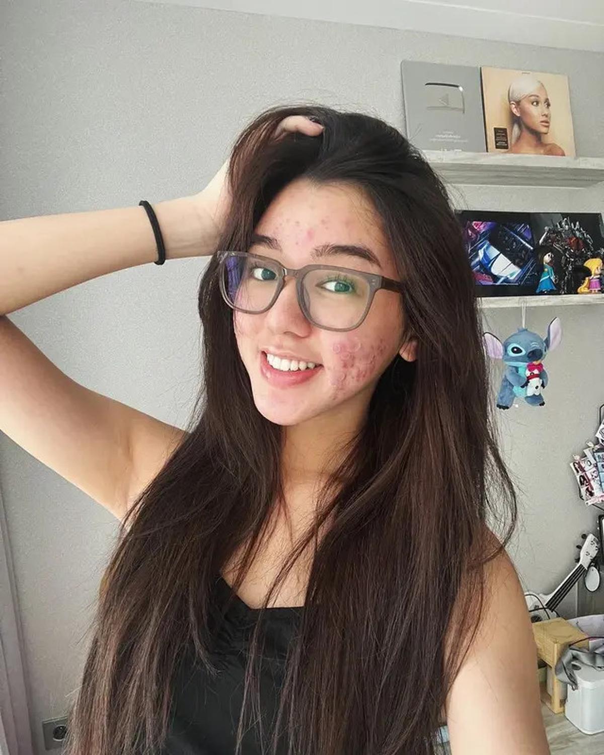 Intip Potret Terbaru Gabriella Ekaputri yang Menginspirasi untuk MencintaiDiriSendiri