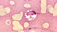 Parasit Leishmania. (Dok: Centers for Disease Control and Prevention's Public Health Image Library)
