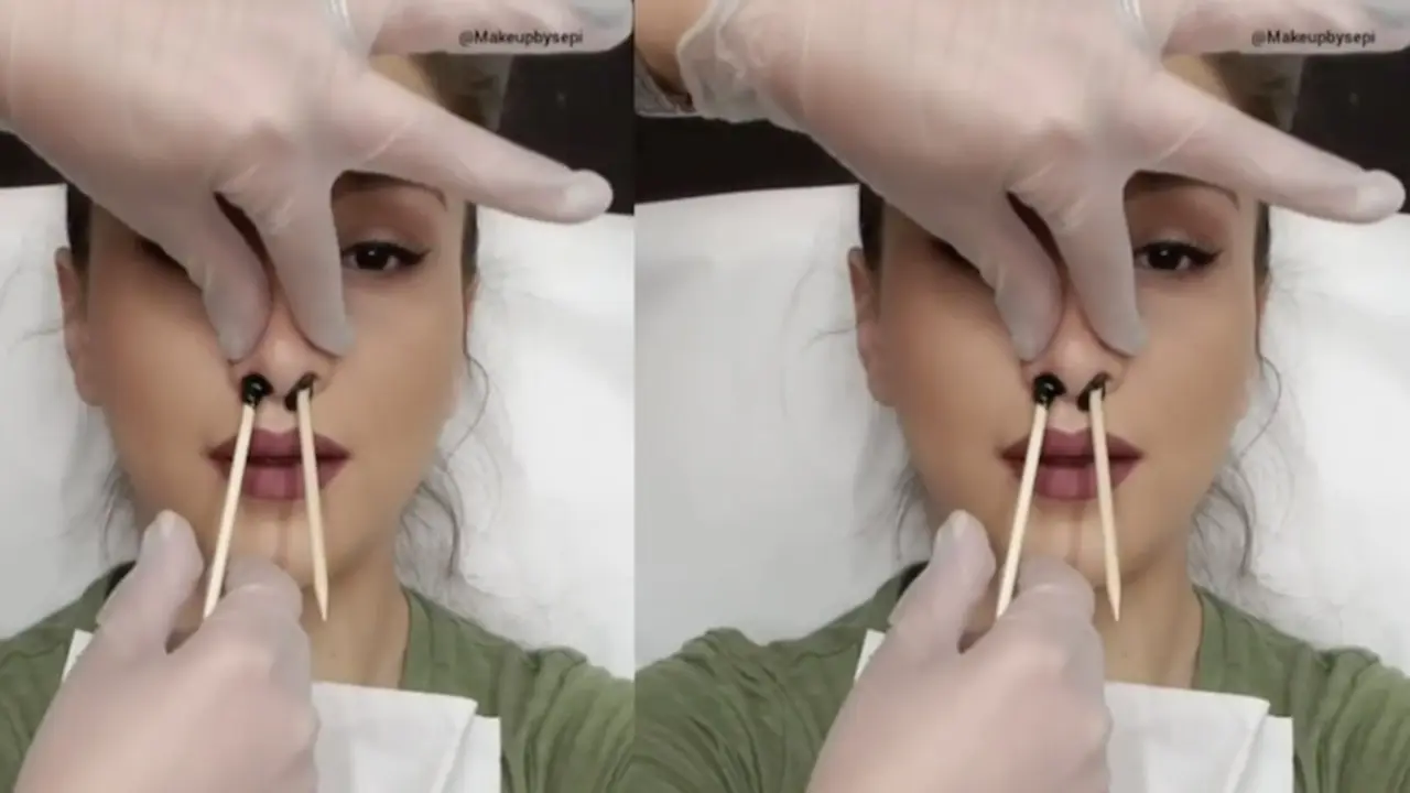 Kenapa Cabut Bulu Hidung Bisa Berbahaya?