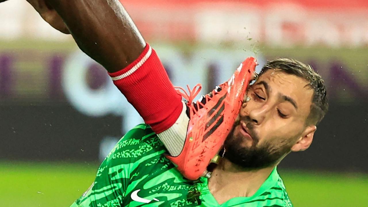 Wajah Donnarumma Berdarah-darah Usai Tendangan Horor Wilfried Singo