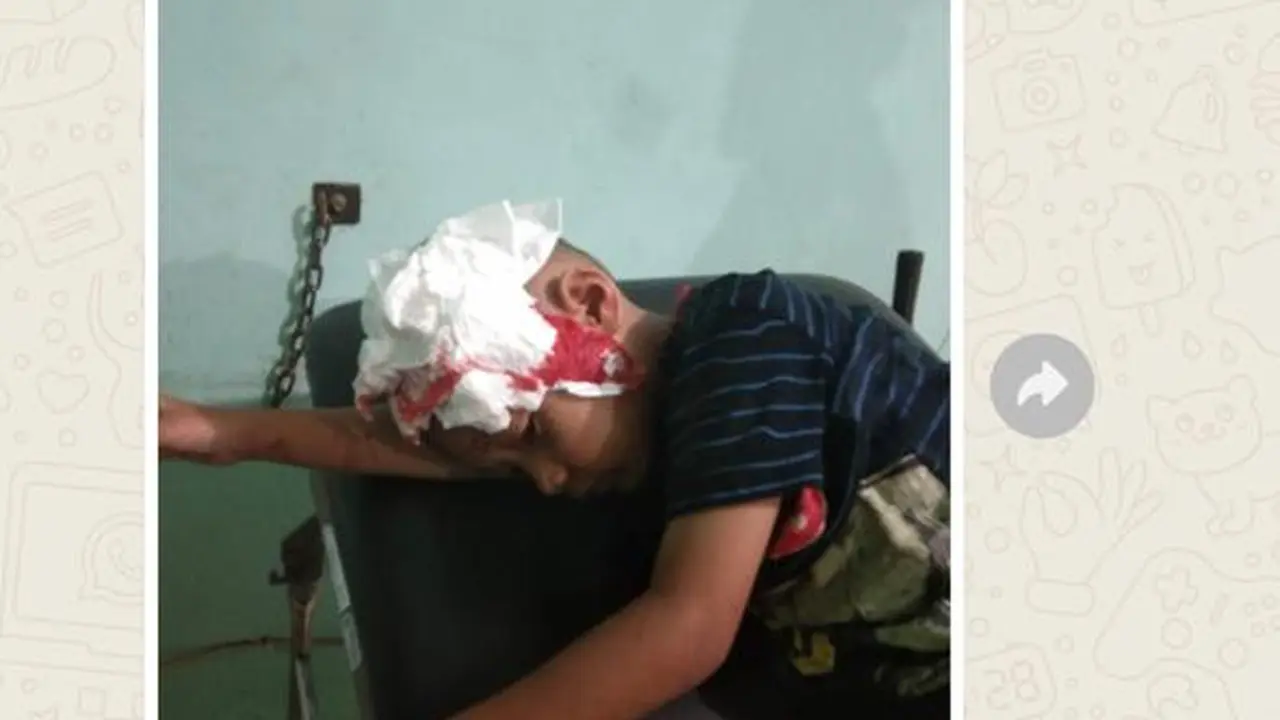 Dua warga Kecamatan Pamengpeuk, Garut, Jawa Barat mendapatkan penanganan Puskesmas akibat mengalami luka di kepala, setelah tertimpa material reruntuhan rumah gempa magnitudo 6.5 Sabtu (27/04/2024) malam. (Liputan6.com/Jayadi Supriadin)