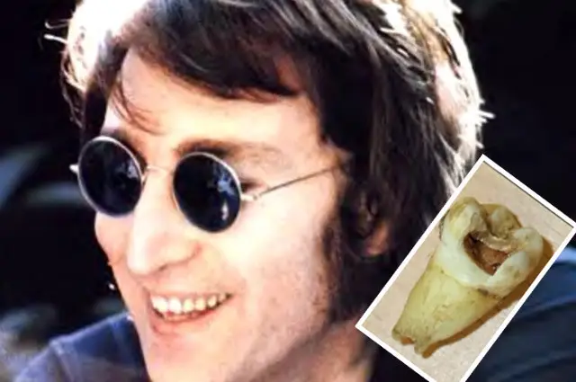 Gigi John dihargai US$31.000