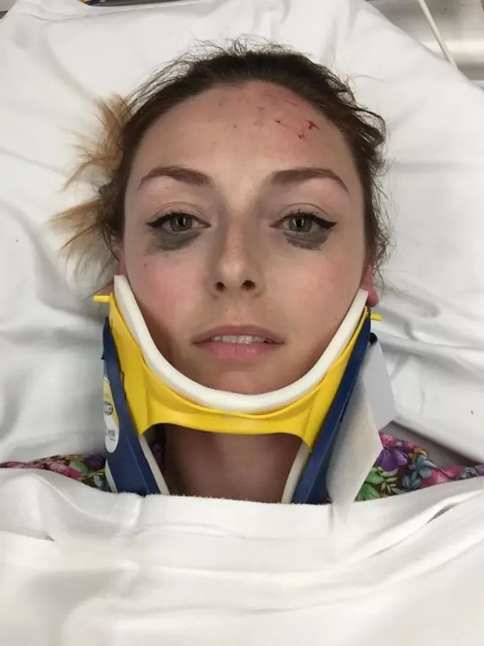 [Bintang] Setelah Kecelakaan Eyeliner Masih Kece, Cewek Ini Langsung Bikin Review