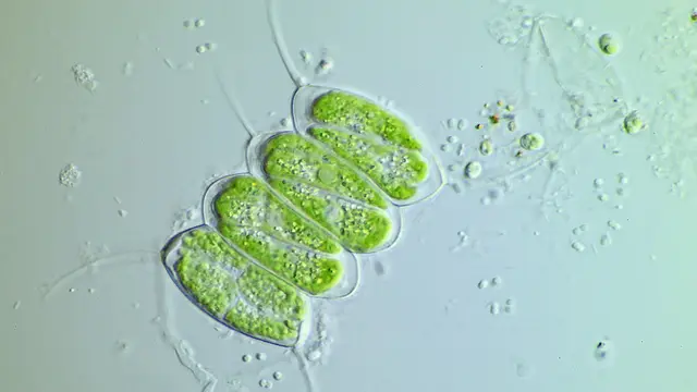 Tampilan mikroskopis alga hijau (Wikimedia Commons)