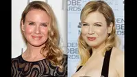 Renee Zellweger sekarang dan dulu. (dok. Gossipcop)