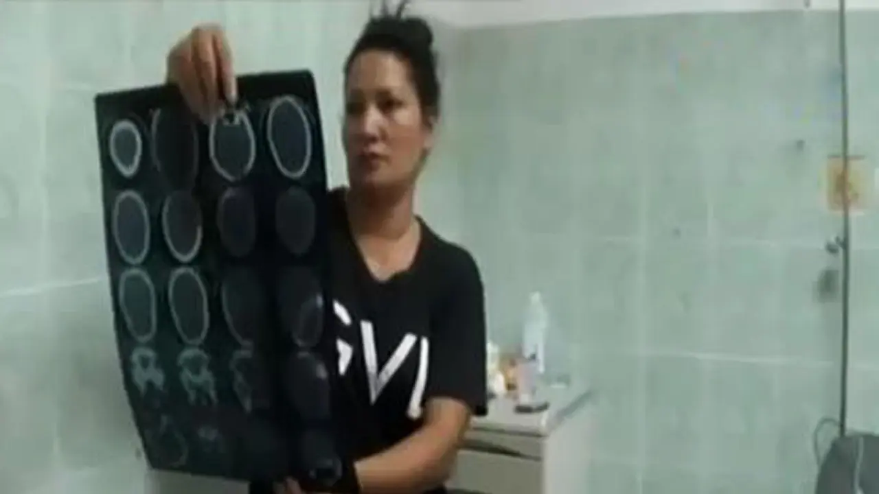 VIDEO: Tempurung Kepala Remaja Ini Pecah Dipukul Oknum Polisi