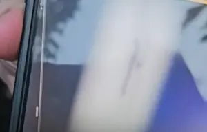 Kronologi Kawat Tertinggal di Jantung Pasien