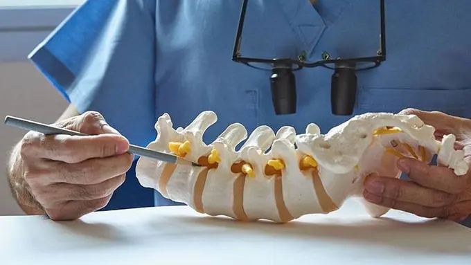 Nyeri tulang belakang/dok. Dr. Kevin Pauza