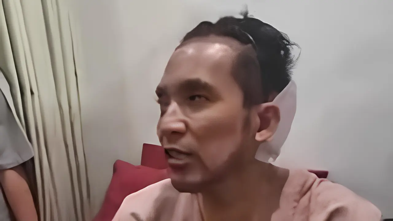 Desta Transplantasi Rambut