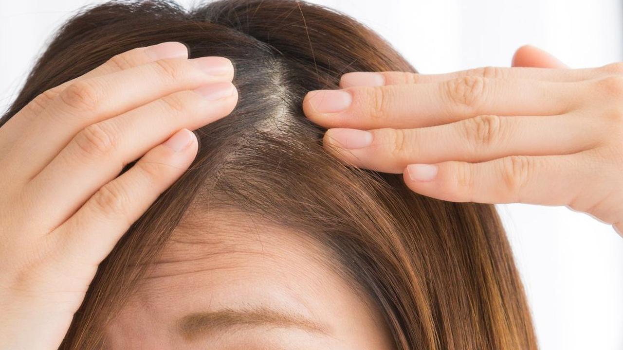 Cara Menghitamkan Rambut Beruban Secara Alami dengan Wijen Hitam dan Madu