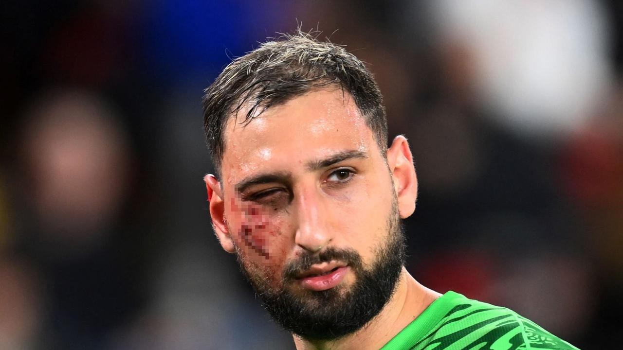 Wajah Donnarumma Berdarah-darah Usai Tendangan Horor Wilfried Singo