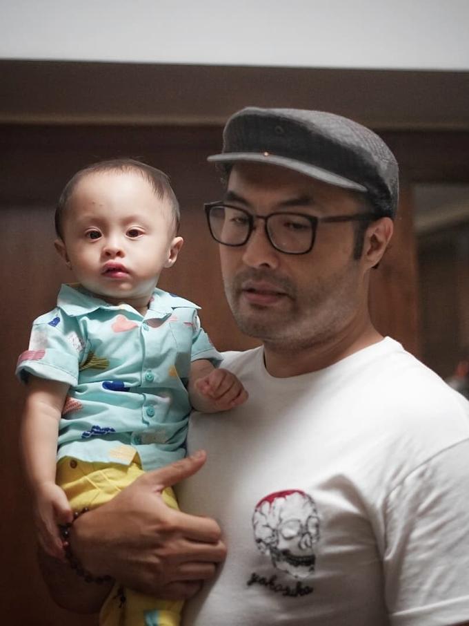 Alasan menyedihkan anak Surya Saputra memakai kacamata - News