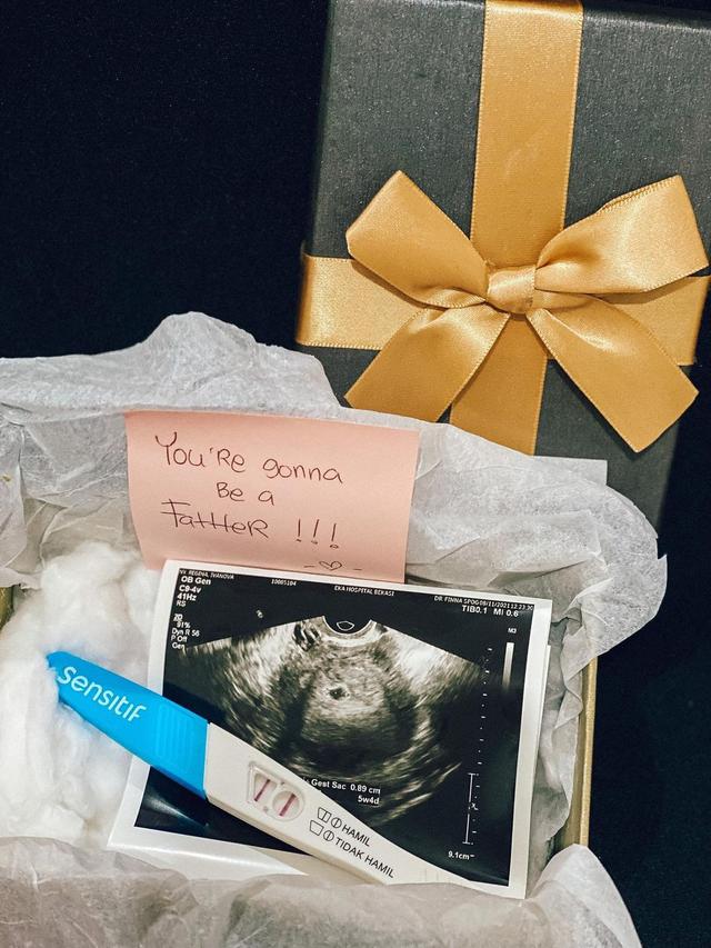 Beri Kejutan Untuk Suami, Ini 5 Momen Regina Ivanova Umumkan Kehamilan