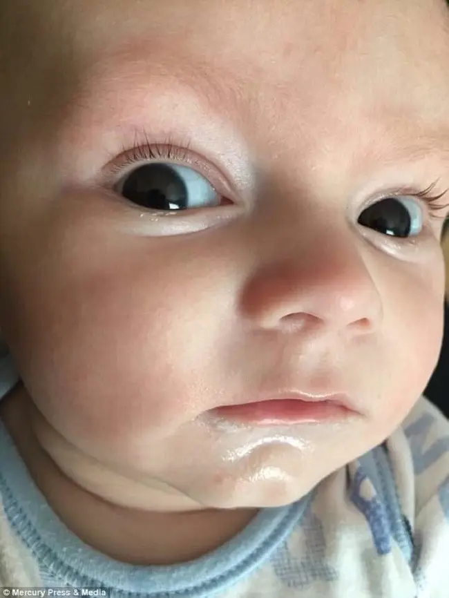 Bayi Alfie yang memiliki raut wajah pemarah. (Sumber Foto: Dailymail)