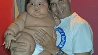 Santiago yang memiliki berat sebesar 19,7 kilogram atau sama dengan berat anak usia enam tahun ini berhasil diselematkan untuk dioperasi