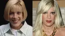 Pada tahun 2000, Tori Spelling mengaku melakukan operasi hidung. (Pinterest)