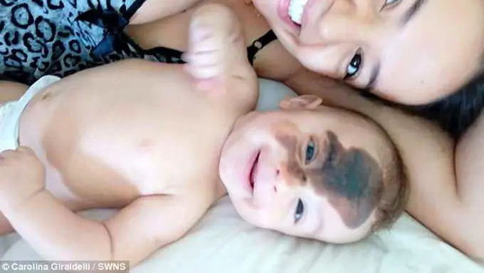 [Bintang] Punya Anak Memiliki Tanda Lahir di Wajah, yang Dilakukan Ibu Ini Bikin Banyak Orang Terharu