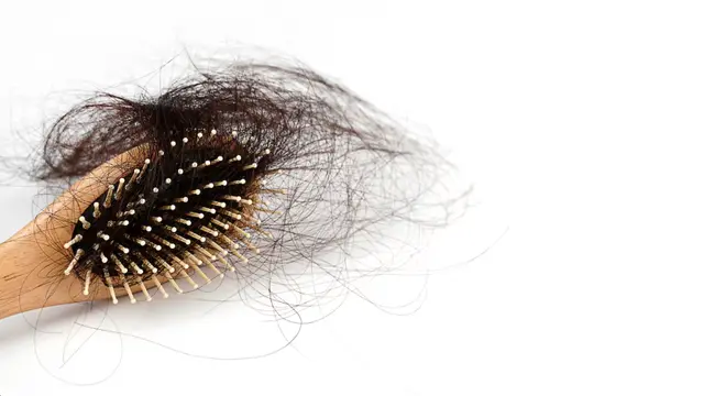 Rambut Rontok Berlebih