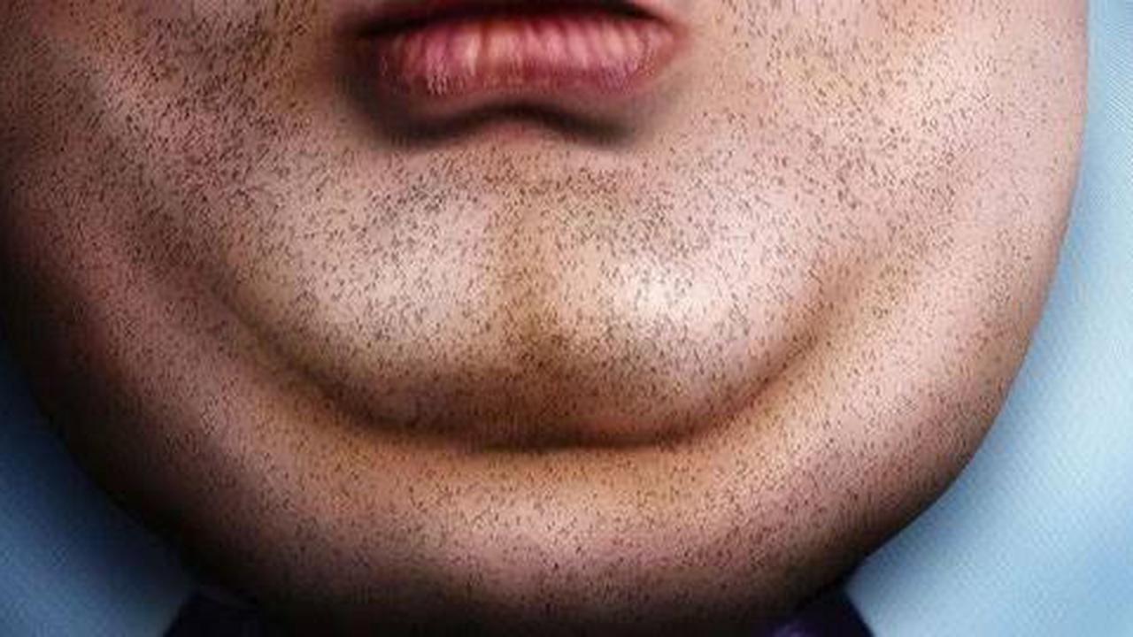 Fenomena 'Zoom Dysmorphia' dan 5 Penyebab Double Chin yang Seringkali Tak Disadari