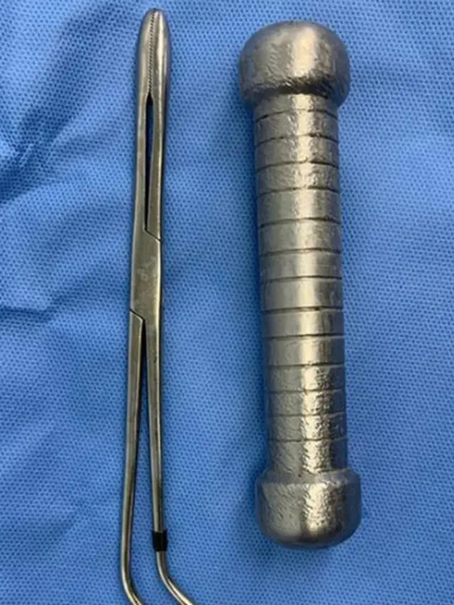 Enggak Habis Pikir, Dumbbell 2kg Tersangkut di Anus Pria Ini