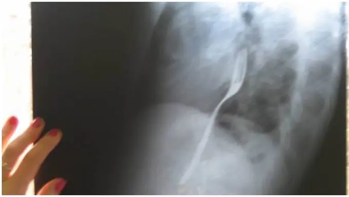 Foto: copyright metro.co.uk