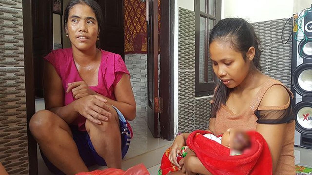 Bayi Tanpa Tempurung Kepala