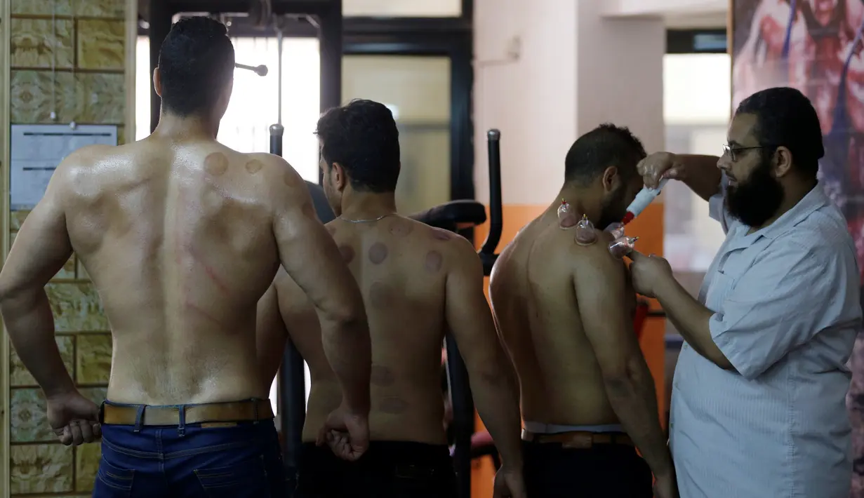 Atlet binaragawan antre untuk menjalani terapi bekam oleh praktisi Al Sheikh Mohamed El-Sayed di sebuah pertandingan Shubra El-Kheima, Kairo, Mesir, (13/08/2016). (REUTERS/Amr Abdallah Dalsh).
