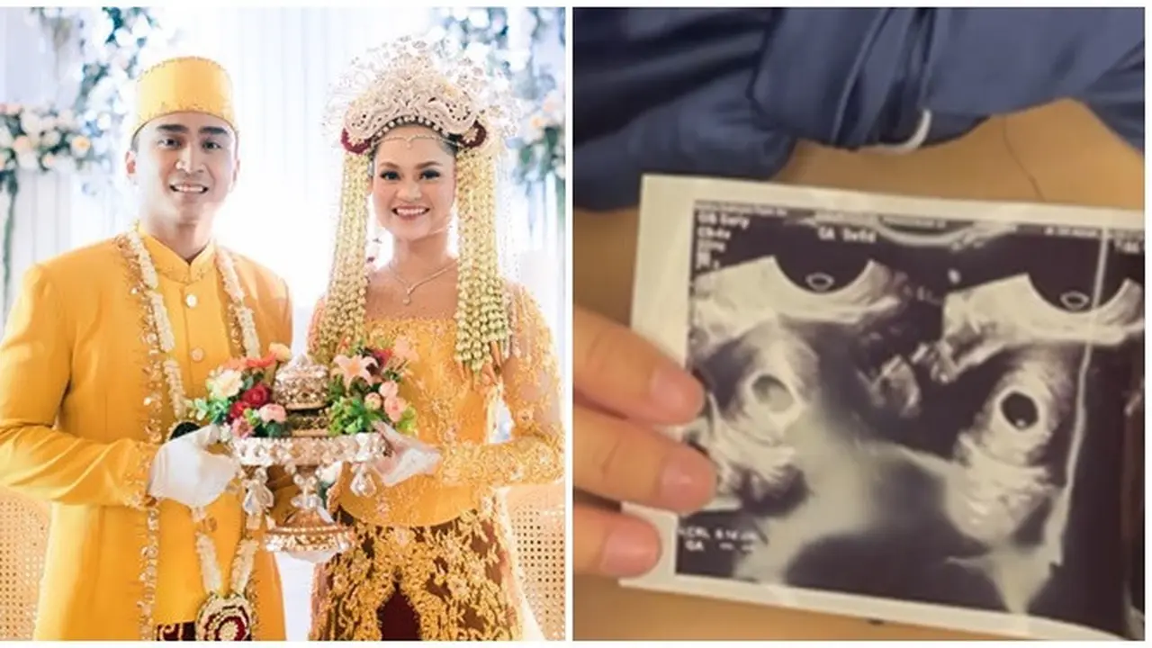 Istri Hamil Anak Pertama, Ini 5 Potret Lutfi Agizal dan Nadya Indry Usai Menikah