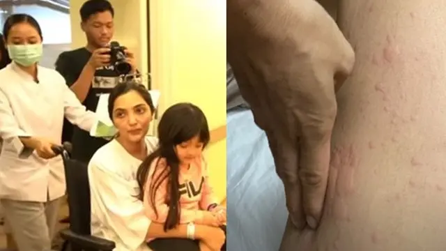 6 Potret Kondisi Ashanty Saat Dirawat, Jalani Operasi Hingga Dijenguk Millendaru