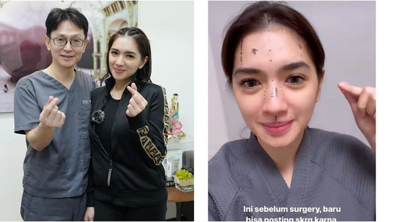 8 Potret Angel Karamoy Jalani Operasi Plastik di Korea Selatan, Curi Perhatian