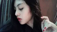 Ayah Sonya Depari Meninggal, Polresta Medan Hentikan Kasus 