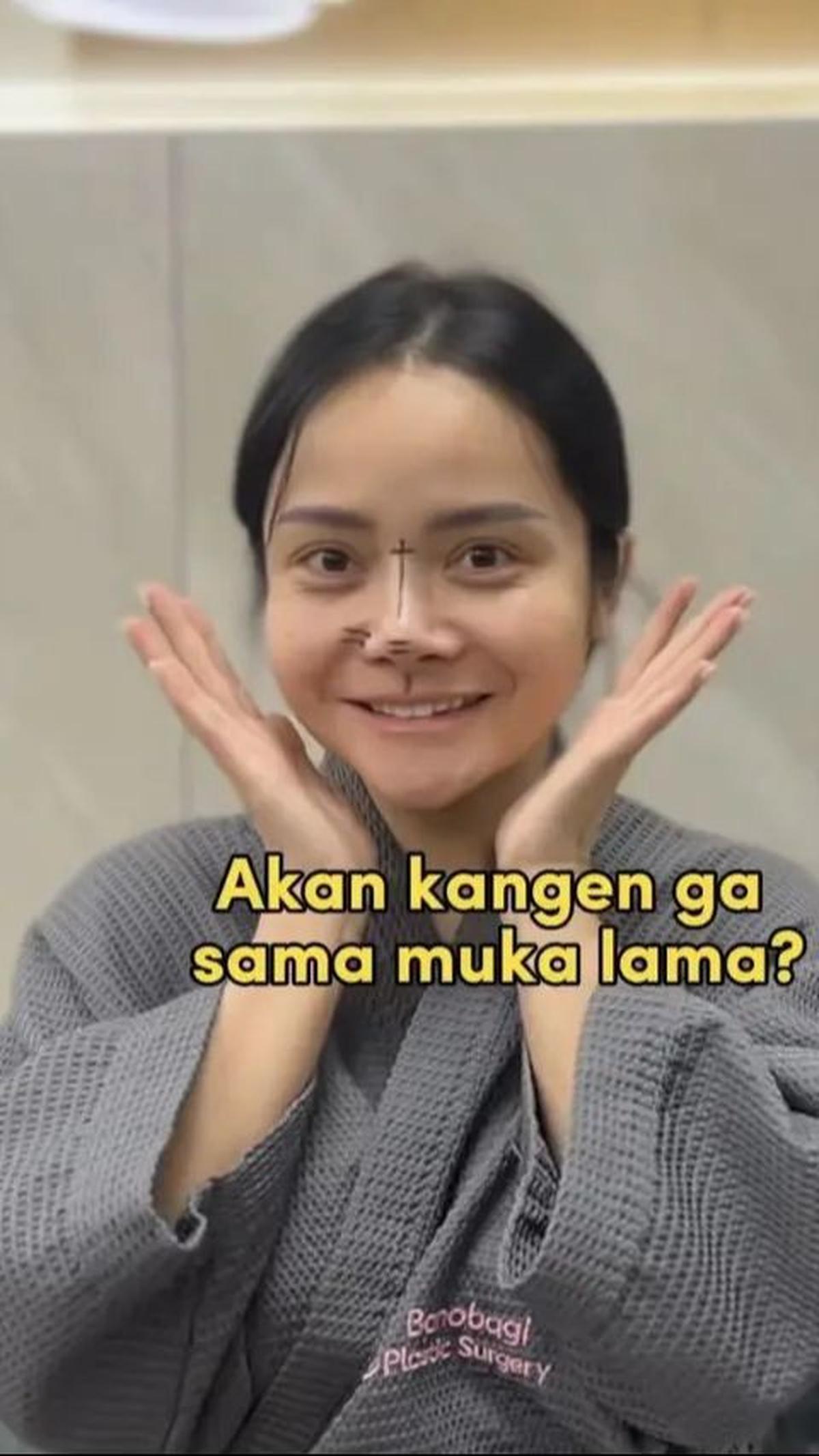 2. Selama hampir sebulan di Korea Selatan, rahasia kecantikan wanita kelahiran 26 Februari 1986 ini mulai terungkap di mata netizen.