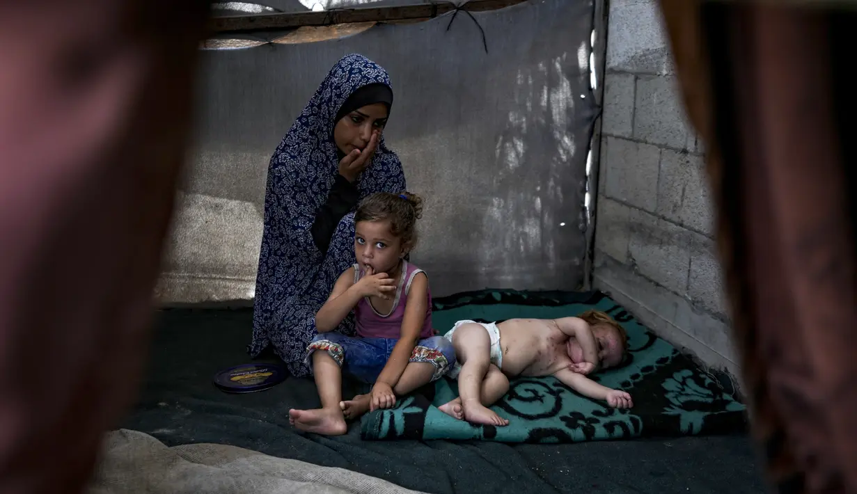 Penyakit kulit merajalela di Gaza, kata para pejabat kesehatan.  (AP Photo/Abdel Kareem Hana )