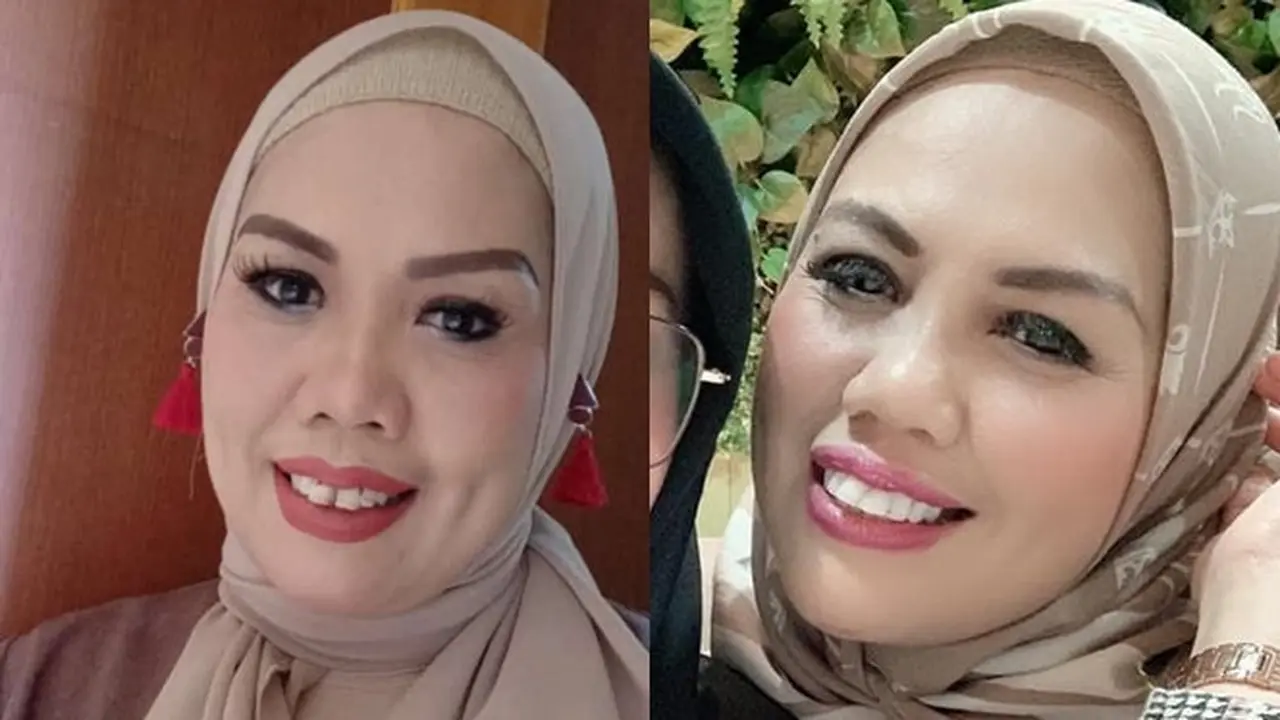 Beda Gaya Ely Sugigi Sebelum Vs Sesudah Potong Gigi