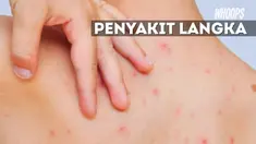 Kini kedua orangtua mencari donatur yang mau mengobati penyakit anaknya.