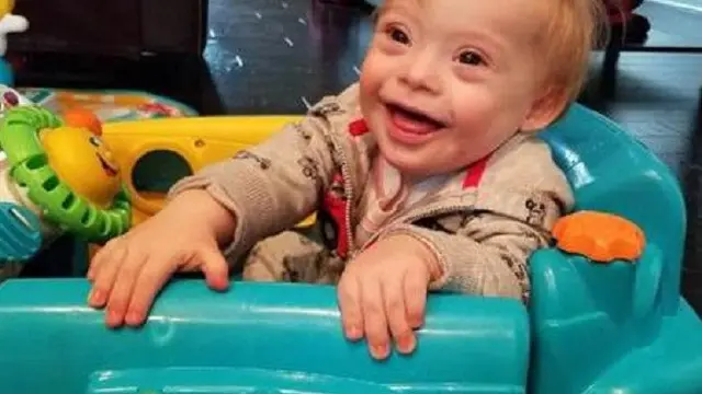 Down Syndrome