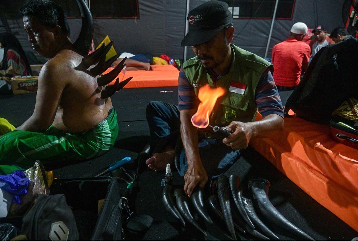 FOTO: Terapi Bekam Tanduk Sapi, Pilihan Lawas di Zaman Modern