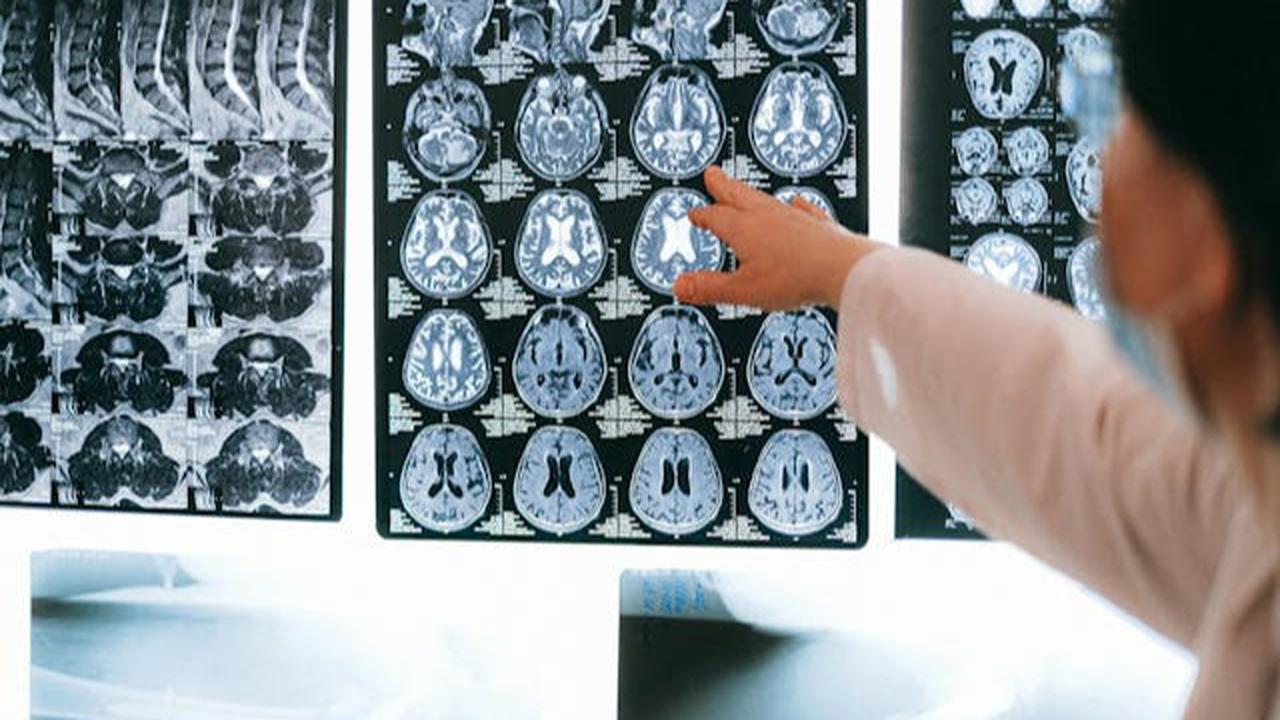 CT Scan atau MRI? Kenali Perbedaan dan Kapan Harus Digunakan