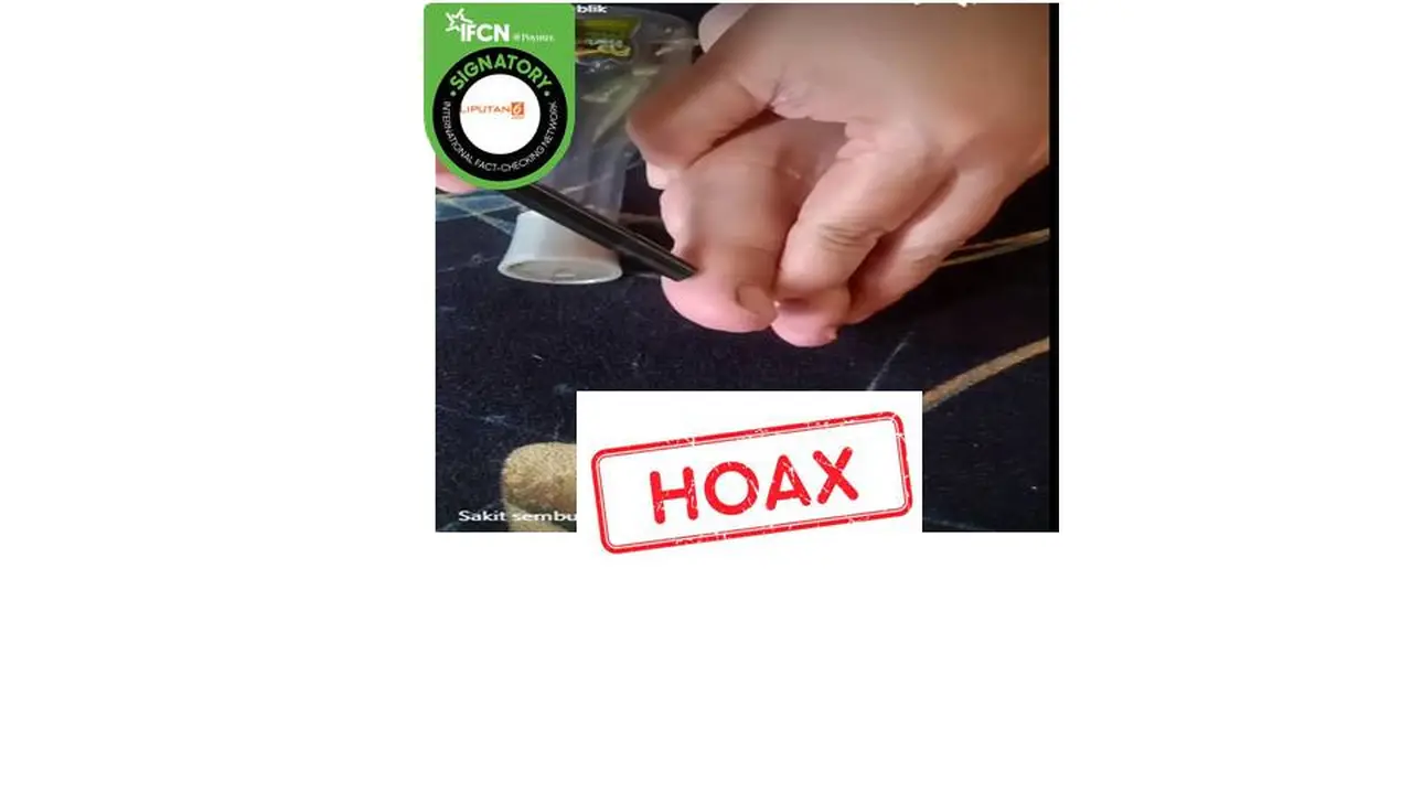 Cek fakta pijat jempol kaki sembuhkan sakit gigi