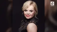 Kate Grant jadi penyandang down syndrome pertama yang mampun meraih gelar ratu kecantikan di Kontes Teen Ultimate Beauty of The World.