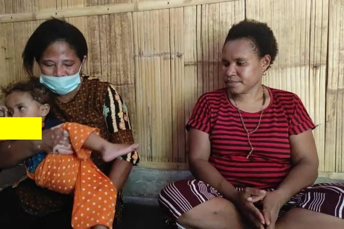 Kristina Yunita 2 Tahun boca yang menderita lida panjang 8,5 Sentimeter di pangku kelurganya dan didampingi ibu kandungnya. (Liputan6.com/ Dionisius Wilibardus)