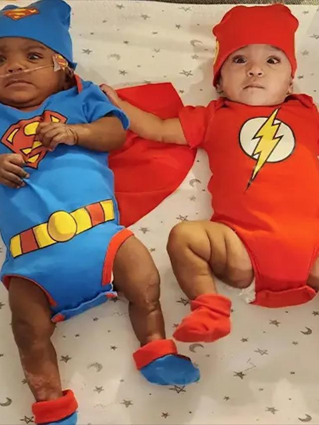 Adiah Laelynn Nadarajah dan Adrial Luka Nadarajah Adalah Nama Bayi Kembar Paling Prematur di Dunia (Sumber: guinnessworldrecords.com)