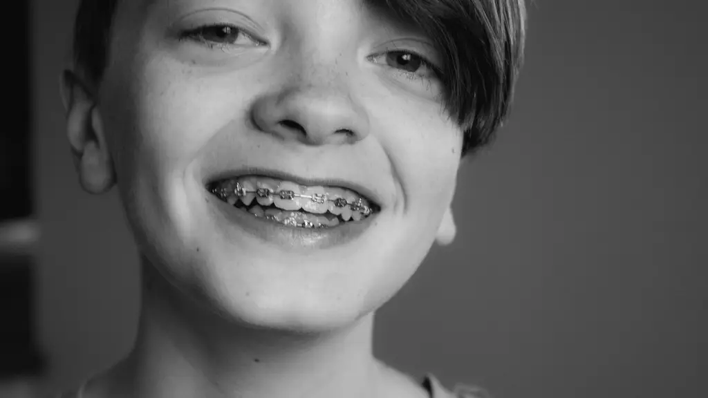 pemasangan kawat gigi dianggap mampu meningkatkan rasa percaya diri anak. Credits: unsplash.com by Jenna Tyson