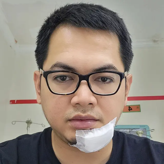 Jatuh hingga Alami Robek di Dagu, Ini 6 Potret Kondisi Tommy Kurniawan