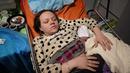 Mariana Vishegirskaya terbaring di ranjang rumah sakit setelah melahirkan putrinya Veronika, di Mariupol, Ukraina, Jumat (11/3/2022). Vishegirskaya selamat dari serangan udara Rusia di sebuah rumah sakit anak dan bersalin di Mariupol pada Rabu lalu. (AP Photo/Evgeniy Maloletka)